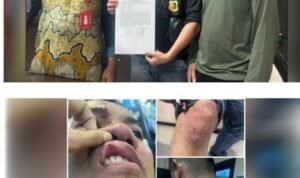 Diduga Lakukan Pengeroyokan kepada Wartawan, Matel dari Perusahaan ACC Finance Dilaporkan di Polres Labuhanbatu Sumut Diduga Lakukan Pengeroyokan kepada Wartawan, Matel dari Perusahaan ACC Finance Dilaporkan di Polres Labuhanbatu Sumut