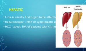 Hemochromatosis-presentation-17-2048.jpg